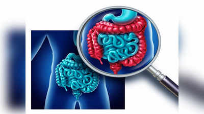 Ulcerative colitis: పేగుపూత ఉన్నవారు.. ఇవి తింటే ప్రమాదం..!