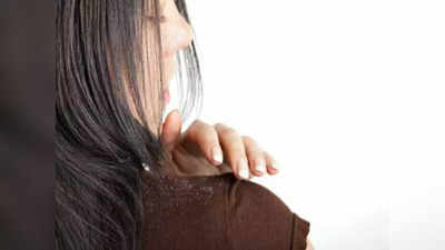 dandruff remedy: താരനെ പമ്പ കടത്താന്‍ നെല്ലിക്കാ പ്രയോഗം