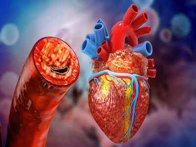 Heart blockage symptoms: 4 लक्षणों से समझें दिल की नसें हो गई हैं ब्लॉक, कभी भी आ सकता है Heart Attack