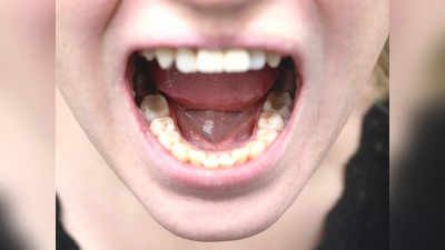 Bad Oral Health: এই ৬টি অভ্যাস এখনই ত্যাগ করুন নইলে বার্ধক্যের আগেই সব দাঁত পড়ে যাবে! ডেন্টিস্টের পরামর্শ শুনুন
