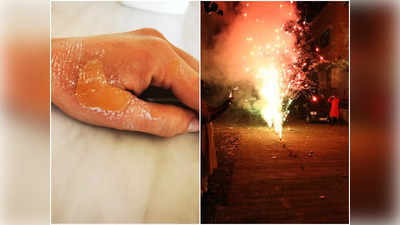 Diwali 2022 Burn Care: কালীপুজো, দীপাবলিতে বাজির আগুনে পুড়তে পারে ত্বক, তড়িঘড়ি কী করবেন জানালেন চিকিৎসক