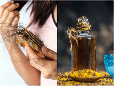 Oils For Hair Growth: চুল উঠে উঠে মাথার সামনে টাক পড়ে যাচ্ছে? ৩ তেলেই হবে মুশকিল আসান, নতুন চুল গজাবে মাত্র ২ সপ্তাহে