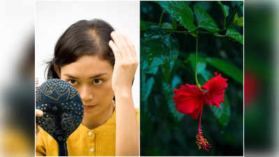 Hibiscus Leaves For Hair: দিন দিন পাতলা হচ্ছে চুল, দেখা যাচ্ছে টাক? জবা ফুলের সঙ্গে ব্যবহার করুন পাতাও, ঠিক এই নিয়ম মেনে