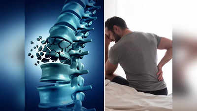 Osteoporosis Diet: Osteoporosis এর সব থেকে বড় সমস্যা রোগটা আসে নিঃশব্দে, সতর্ক হন এখন থেকেই!