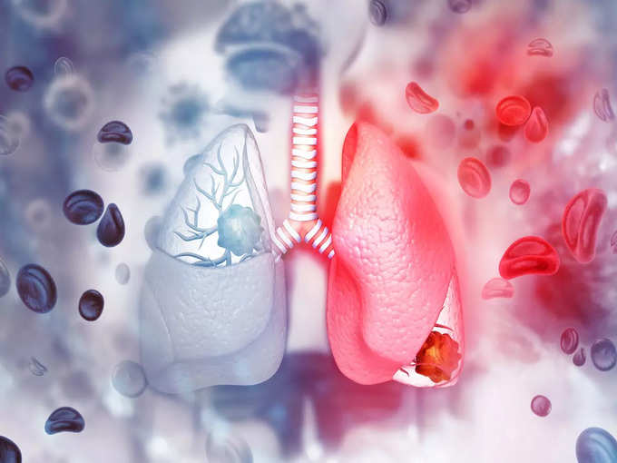 ​৫. ফুসফুসের জন্য ভালো জোয়ান (Lungs)
