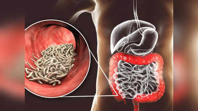 Stomach Worms: വയറ്റിലെ വിരശല്യം അകറ്റാന്‍ ഇതാ ചില പൊടിക്കൈകള്‍