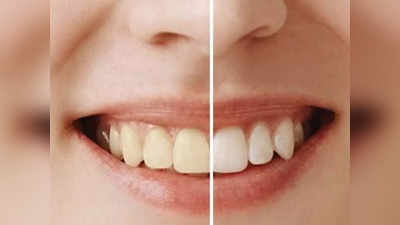 पीले दांतों को आसानी से करें साफ, इन Tooth Powder के इस्तेमाल से मिलेगी मोतियों जैसी सफेद मुस्कान