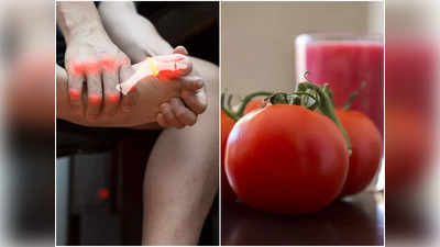 Tomatoes and Gout: টমেটো খেলেই কি গাউটের ব্যথা বাড়ে, Uric Acid রোগীদের প্রশ্নের উত্তর দিলেন চিকিৎসক