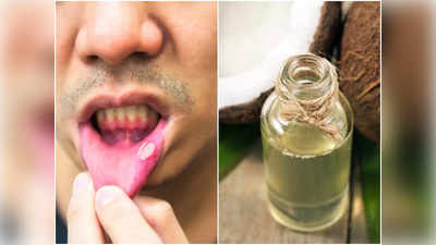 Mouth Ulcer Home Remedy: মুখের আলসারে কষ্ট পাওয়ার দিন শেষ, এবার ঘরোয়া উপায়েই সমস্যা দূর করুন