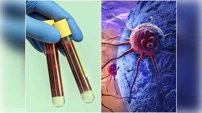 Blood Test for Cancer: ১ টেস্টেই ধরা পড়বে ৫০ ধরনের ক্যানসার, গোড়াতেই রোগ ধরে বাঁচানো যাবে অসংখ্য প্রাণ