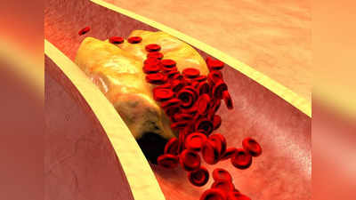 High Cholesterol : కాళ్ళు ఇలా ఉంటే కొవ్వు  ఎక్కువగా ఉన్నట్లేనట..