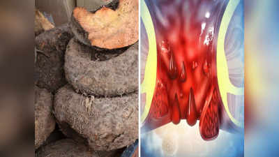 Food for Piles: बिना चीर-फाड़ होगा बवासीर का इलाज, Ayurveda डॉ. ने माना पाइल्स को जड़ से मिटा देगी ये खास सब्जी