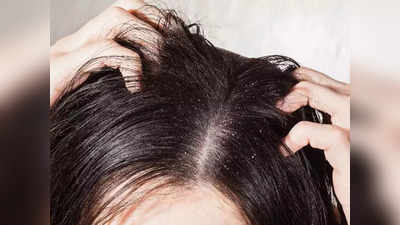 Scalp Itching Remedies: തലയിലെ ചൊറിച്ചില്‍ മാറ്റിയെടുക്കാന്‍ ഇതാ പൊടിക്കൈകള്‍