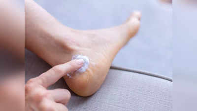 How to heal Cracked Heels: రాత్రి ఈ ఆయిల్‌ రాస్తే.. కాళ్ల పగుళ్లు మాయం అవుతాయ్..!