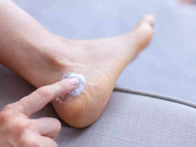 How to heal Cracked Heels: రాత్రి ఈ ఆయిల్‌ రాస్తే.. కాళ్ల పగుళ్లు మాయం అవుతాయ్..!