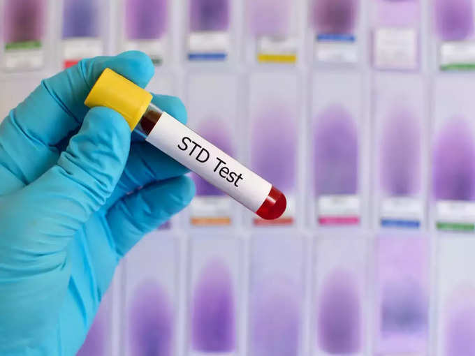 STD का टेस्ट