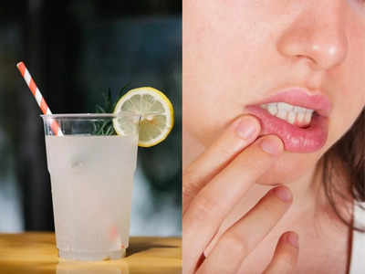 लेमोनेड पीने के बाद होने लगती है होंठ में खुजली, तो इस एलर्जी के शिकार हैं आप; जानिए लक्षण और उपचार