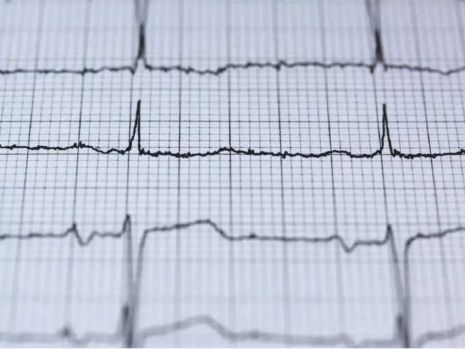 ​AliveCor single-lead ECG डिवाइस