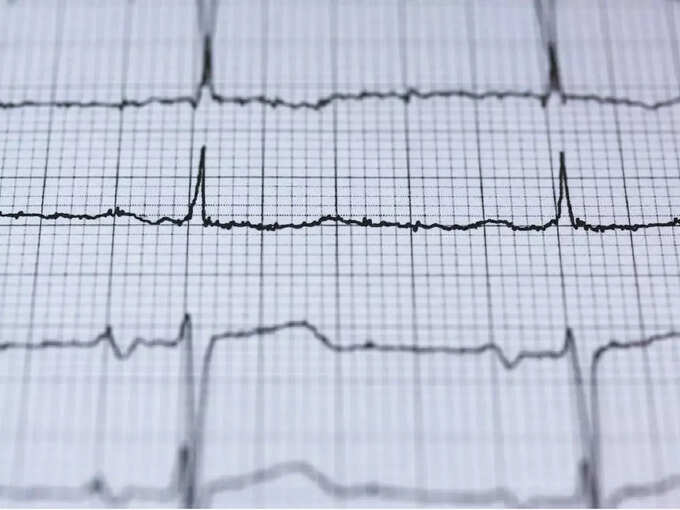 ​AliveCor single-lead ECG डिवाइस