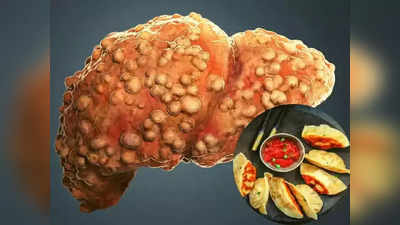 Cirrhosis Symptoms : सायलेंट किलर आहे Liver चा हा आजार, लास्ट स्टेजमध्ये दिसतात लक्षणे, तात्काळ सोडा ही ५ कामे