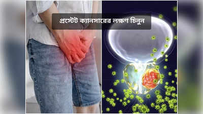 Prostate Cancer Symptoms: প্রস্টেট ক্যানসার প্রথমেই ধরা পড়লে বাঁচে প্রাণ! অসুখের লক্ষণ, চিকিৎসা জানালেন অঙ্কোলজিস্ট