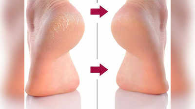 Cracked Heels Remedy : फटी एड़ियों को कोमल बना सकती हैं ये क्रैक Heel Repair Cream, पाएं सॉफ्ट और स्मूद फीट