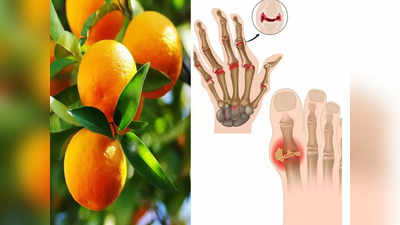 Best fruits for Uric Acid: जोड़ों में चिपके यूरिक एसिड को चूस कर खत्म कर देंगे 5 फल, Gout से भी होगा बचाव
