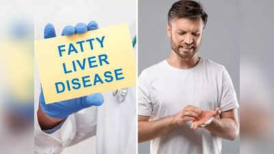 Nonalcoholic Fatty Liver Disease: मेदांता डॉक्टर से जानिए नॉन-एल्कोहलिक फैटी लिवर डिजीज के लक्षण, बचने के उपाय