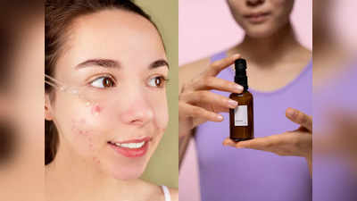 ये Face Serum एक्‍ने प्रोन स्‍किन के लिए हैं बेहद फायदेमंद, रेगुलर इस्‍तेमाल से मिलेगा जल्‍दी असर