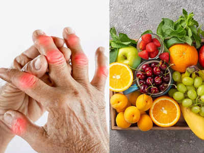 Best fruits for Uric Acid: सांध्यातील युरिक अ‍ॅसिडला खेचून बाहेर फेकतील ही ५ फळं, Gout ची समस्या देखील होईल कमी