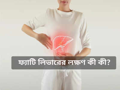 মদ না খেলেও জমে লিভারে মেদ, Non Alcoholic Fatty Liver Disease-এর লক্ষণ জানালেন চিকিৎসক