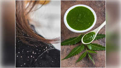 Neem For Dandruff: শীত পড়তেই মাথায় ভরে যাচ্ছে খুশকি? নিম পাতার সঙ্গে এই উপাদান মিশিয়ে মাত্র ১ বার লাগিয়ে দেখুন