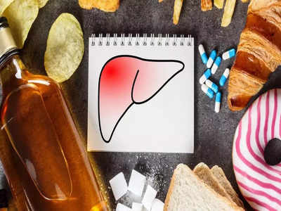 Tips for Healthy Liver: మీ లివర్‌ ఆరోగ్యంగా ఉండాలంటే.. వీటికి కచ్చితంగా దూరంగా ఉండాలి..!