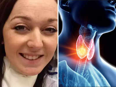 ड्राई स्किन-टूटते बाल समेत Thyroid Cancer के वो 5 लक्षण जिन्हें नजरअंदाज करना पड़ा इस महिला को महंगा!