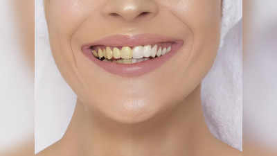 Tooth Discoloration: দাঁত কি হলুদ হয়েগিয়েছে? এই ১০টি রোগে আক্রান্ত হতে পারে, তাই সাবধান হন এখন থেকেই!