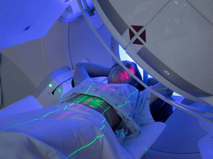 ​கதிர்வீசு்சு அறுவை சிகிச்சை (radiation therapy)