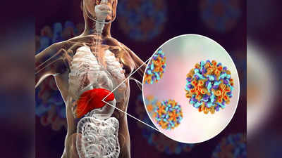ஹெபடைடிஸ் பி ஒரு மோசமான கல்லீரல் நோயா? அதன் அறிகுறிகள், சிகிச்சைகள் என்னென்ன...