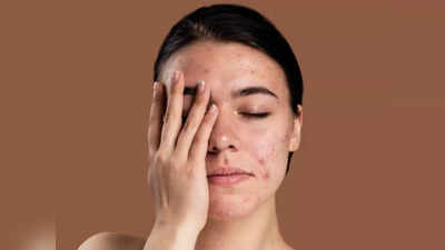 Skin Care in Winter: શિયાળામાં ડ્રાયનેસના કારણે થતાં ચામડીના રોગોને દૂર કરશે આયુર્વેદિક ડોક્ટરના 6 ઘરેલૂ નુસખા