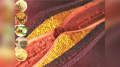 Foods that lower cholesterol: खून की नसों में जमा गंदे फैट LDL को कम करके अच्छे फैट HDL को बढ़ाते हैं ये 5 फूड!