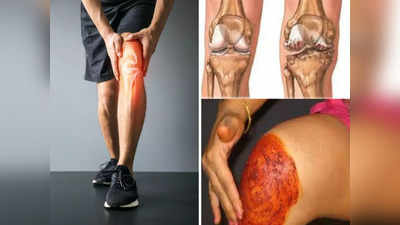 Ayurvedic Treatment for Joint Pain: ठंड में बढ़ने लगा घुटनों का दर्द? बिना दवा या बाम राहत देंगे आयुर्वेद डॉ. के ये 4 सस्ते नुस्खे