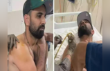 मोहम्मद शमीचे रुग्णालयातील फोटो समोर; किती गंभीर आहे दुखापत