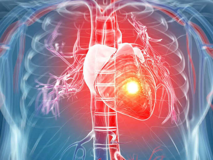 ​उच्च रक्तदाब हे हृदयविकाराचे मूळ