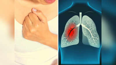 Pleurisy (Pleuritis): खांसते समय होता है Chest Pain, तो समझ जाएं हो गई ये बीमारी; जानलेवा बनने से पहले ऐसे करें इलाज