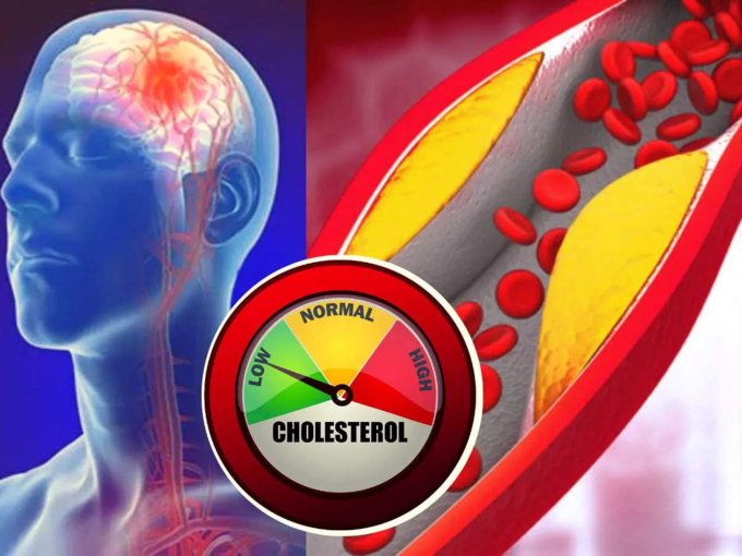 ​கொலஸ்டிரால் அளவுகள் (average cholesterol levels)