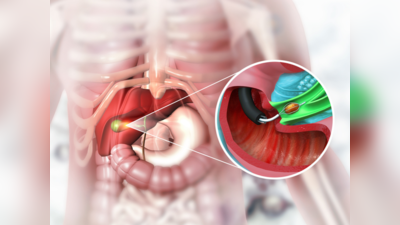 Gallbladder Stones: पित्ताशय की पथरी इन 4 हिस्सों में दर्द से हालत कर देगी खराब, इन 5 आसान उपायों से करें बचाव