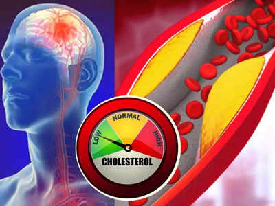 Foods for lowering cholesterol: കൊളസ്‌ട്രോള്‍ കുറയ്ക്കണോ? കഴിക്കാം ഈ ആഹാരങ്ങള്‍