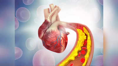 Cholesterol: শীতে কোলেস্টেরল বশে নেই? তাহলে এই ৫টি খাবার রাখুন দ্রুত ফল পাবেন