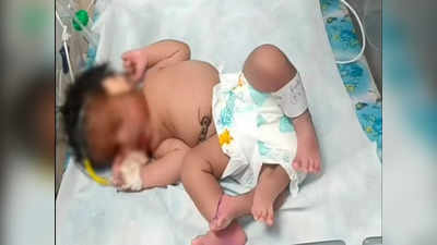 Baby With Four Legs: ವಿಚಿತ್ರ ಘಟನೆ: ಮಧ್ಯಪ್ರದೇಶದಲ್ಲಿ ನಾಲ್ಕು ಕಾಲುಗಳ ಹೆಣ್ಣುಮಗು ಜನನ