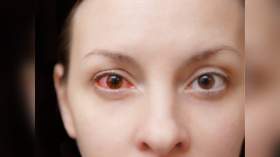 Pink Eye Tips: कंजक्टिवाइटिस ग्रसित आंखों को देखने से होता है? जानें आंख आने का कारण, उपचार और बचाव का तरीका