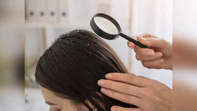 Anti Dandruff Shampoo से बालों का झड़ना हो सकता है कम, हेयर ग्रोथ में भी फायदेमंद